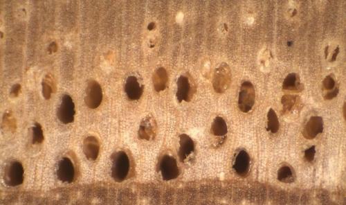 Расширенные поры с возрастом. Расширенные поры –, что это?