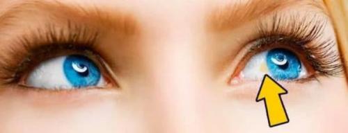 Желтые пятна под глазами у ребенка причины. Лечение