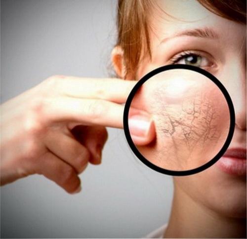 Витамины при сухости и шелушении кожи. Как пополнить витамины при сухости и шелушении кожи