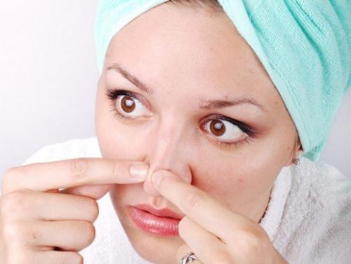 Черные точки на носу, что это. Причины черных точек на носу