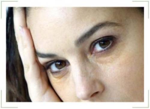 Желтые пятна под глазами у женщин. О, каких заболеваниях говорит желтизна?