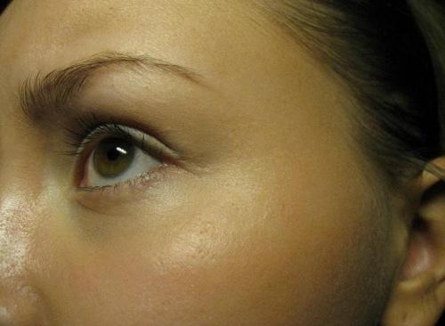 Как убрать жирный блеск с лица. Как быстро убрать жирный блеск с лица в домашних условиях? 01