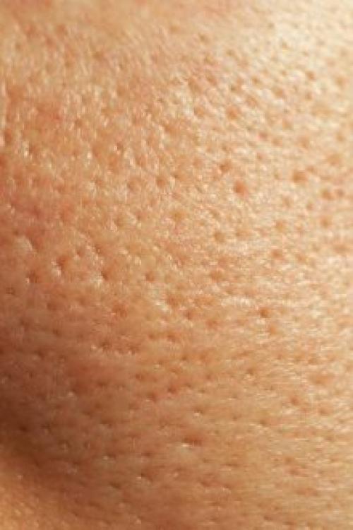 Средства сужающие поры. Крем, сужающий поры на лице: всем ли нужен и как найти подходящий