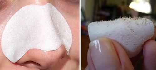 Полоски на нос от черных точек, как пользоваться. Полоски для очищения пор носа от черных точек —, как пользоваться и какой эффект получим?