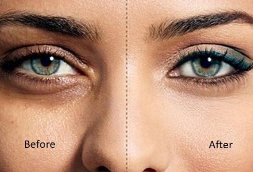 Темные круги под глазами печень. Полезные видео-ролики о причинах потемнения кожи вокруг глаз