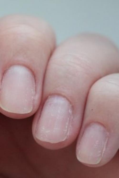 Почему гель на ногтях отслаивается. Почему отслаивается гель-лак от ногтей: причины и особенности