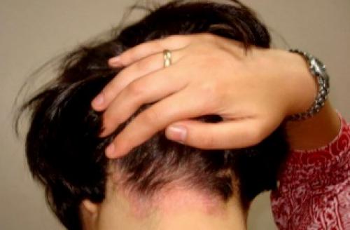 Дегтярное мыло чем полезно для волос. Польза мыла с березовым дегтем для волос 02