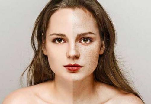 Как скрыть веснушки с помощью макияжа. Как замаскировать веснушки с помощью макияжа: обзор средств и пошаговая инструкция 01