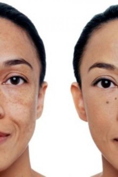 Зеленый корректор для лица, как пользоваться. Зеленый консилер для лица – идеальное средство маскировки недостатков кожи