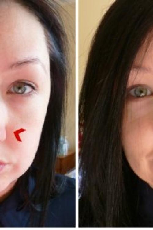 Зеленый корректор для лица, как пользоваться. Зеленый консилер для лица – идеальное средство маскировки недостатков кожи