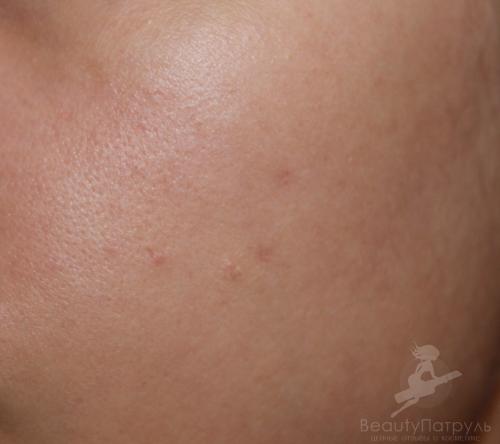 Зеленый корректор для лица, как пользоваться. Зеленый консилер для лица – идеальное средство маскировки недостатков кожи 27