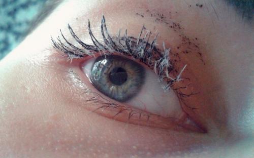 Аллергия на тушь для ресниц. Лечение аллергии на тушь для ресниц 04 Аллергия на тушь для ресниц. Лечение аллергии на тушь для ресниц 04