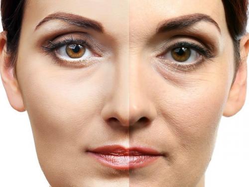 Ботокс последствия. Немного истории