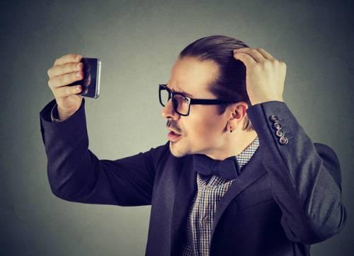 Выпадение волос у женщин после 50 лет причины и лечение. Классификация облысения 10 Выпадение волос у женщин после 50 лет причины и лечение. Классификация облысения 10