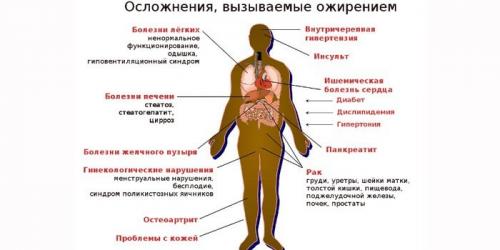 Ожирение 2 степени: как лечить заболевание