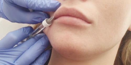 Как выбрать форму губ для увеличения. Выбираем форму, при увеличении губ