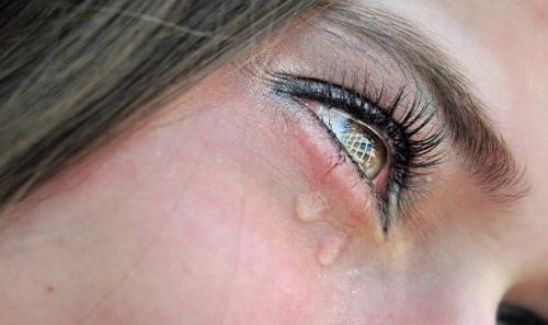 Снять отек с глаз быстро после слез. Быстро снять отек с глаз после слез