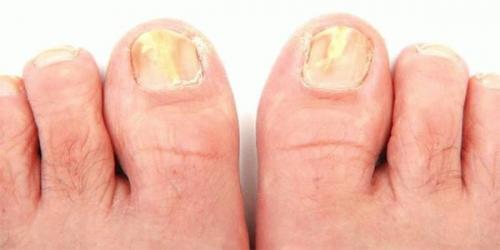 Обнаружены нити мицелия. Нити мицелия 05 Обнаружены нити мицелия. Нити мицелия 05