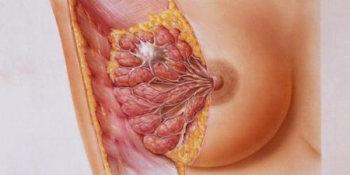 Фиброзная мастопатия лекарства. Каким должно быть лечение фиброзно-кистозной мастопатии: обзор эффективных средств и отзывы женщин