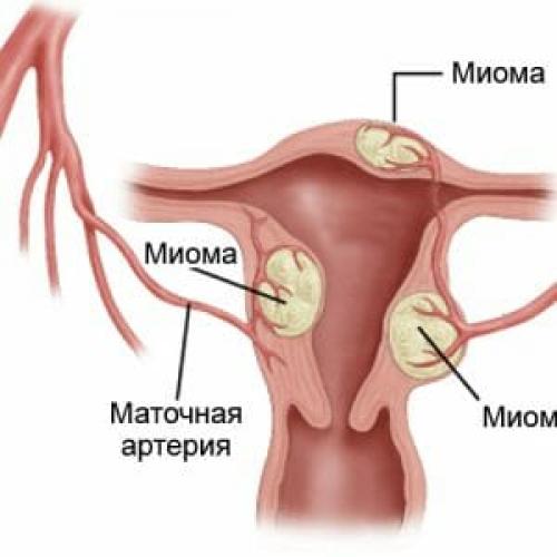 Фиброзная мастопатия лекарства. Консервативная терапия мастопатии молочной железы