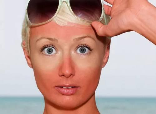 Красный цвет лица. Физиологические причины