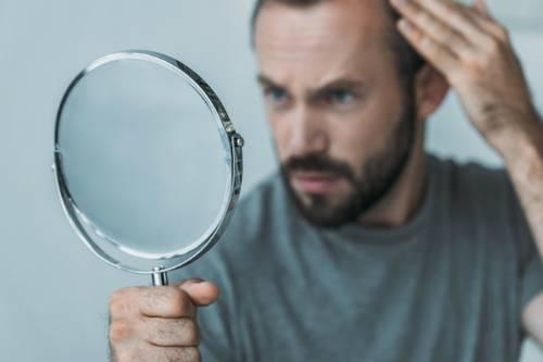 Выпадение волос у женщин после 50 лет причины и лечение. Классификация облысения 09 Выпадение волос у женщин после 50 лет причины и лечение. Классификация облысения 09