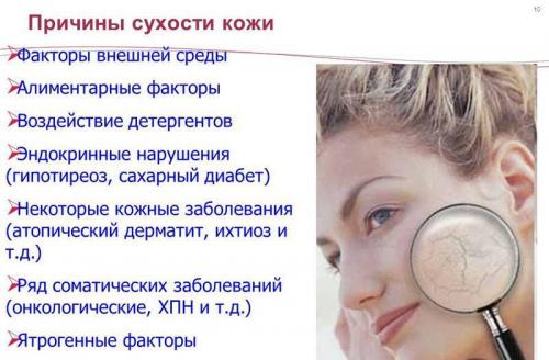 Сухая кожа, какой витамин пить. Причины сухости кожи