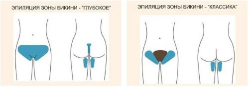 Как убрать волосы в зоне глубокого бикини. Суть процедуры эпиляции в зоне глубокого бикини