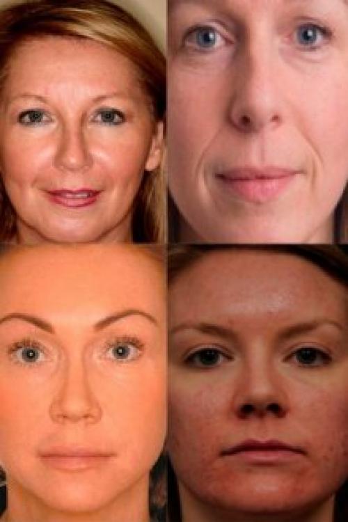 Крем с лифтинг-эффектом рейтинг. Крем с лифтинг-эффектом для лица: обзор лучших средств