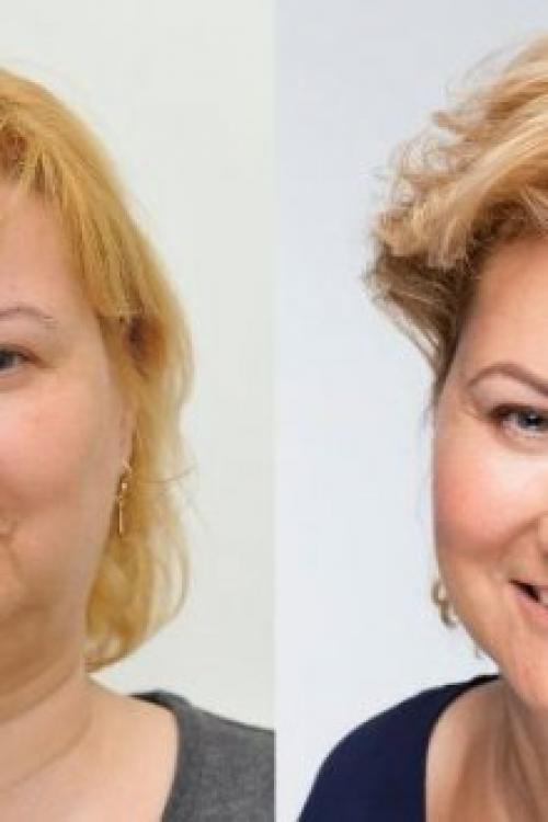 Крем с лифтинг-эффектом рейтинг. Крем с лифтинг-эффектом для лица: обзор лучших средств