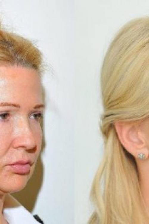 Крем с лифтинг-эффектом рейтинг. Крем с лифтинг-эффектом для лица: обзор лучших средств