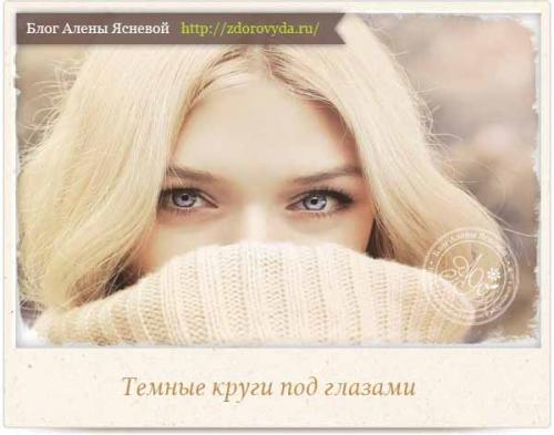 Темные круги под глазами, как убрать. Почему появляются темные круги под глазами? 01 Темные круги под глазами, как убрать. Почему появляются темные круги под глазами? 01