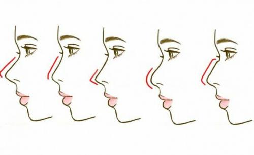Как визуально уменьшить нос с горбинкой. Как уменьшить нос с помощью макияжа техникой контурирования