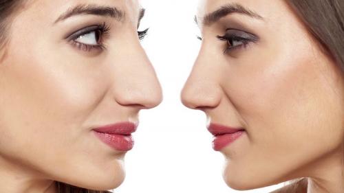 Как визуально уменьшить нос с горбинкой. Как уменьшить нос с помощью макияжа техникой контурирования