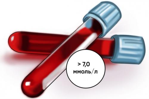 Нормальный уровень сахара в крови у взрослых. Какая норма сахара в крови?