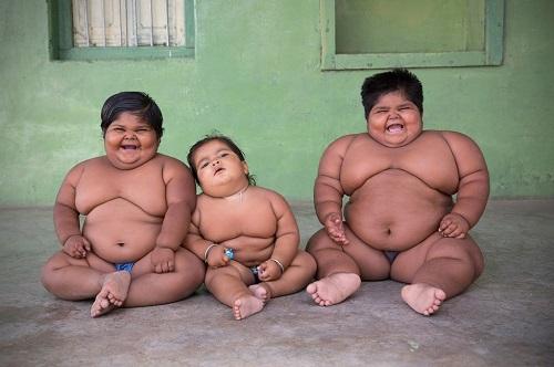 Степени ожирения у детей таблица. Как определить — таблица стадий по возрасту