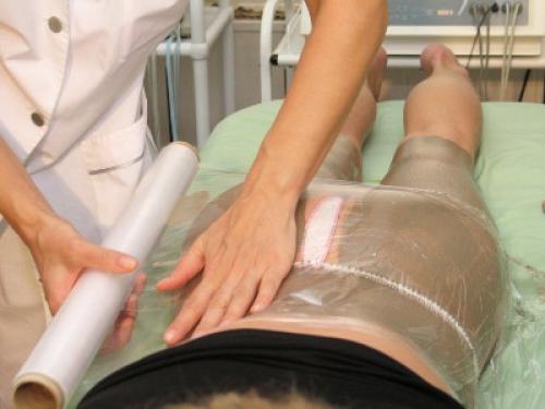 Обертывания от целлюлита в салоне. Антицеллюлитные обертывания