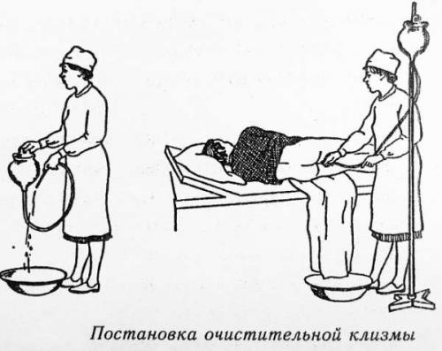 С чем делать клизму. Очистительная клизма: основные сведения 01 С чем делать клизму. Очистительная клизма: основные сведения 01