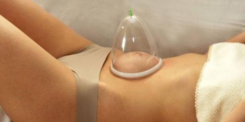 Массаж вакуумными банками на животе. Что такое баночный массаж живота