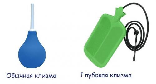 Чем делать клизму. Очистительная клизма: основные сведения 02 Чем делать клизму. Очистительная клизма: основные сведения 02