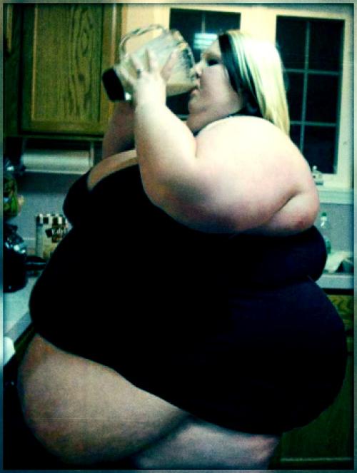 Морбидное ожирение лечение. Диета 03 Морбидное ожирение лечение. Диета 03