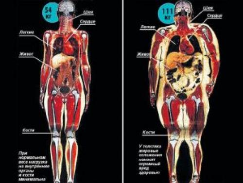 Ожирение внутренних органов фото
