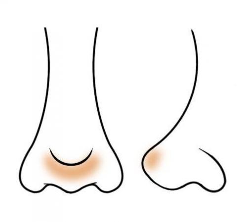 Контуринг носа. Контуринг проблемных участков