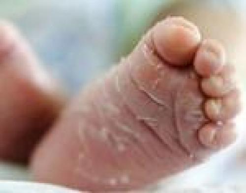 Шелушение кожи ног