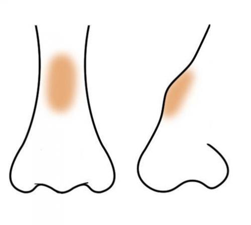 Контуринг носа. Контуринг проблемных участков