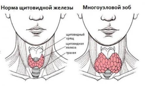 Почему постоянно хочется есть и спать. Дневная сонливость – предупреждение о серьезных болезнях