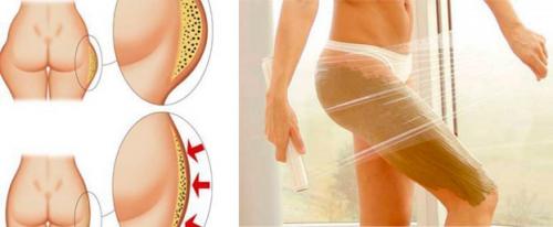 Горчичные обертывания для похудения. Почему горчица работает для похудения 02 Горчичные обертывания для похудения. Почему горчица работает для похудения 02