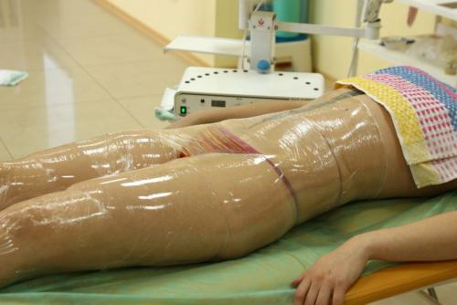 Обертывания от целлюлита. Как правильно проводить домашние антицеллюлитные обертывания? 04 Обертывания от целлюлита. Как правильно проводить домашние антицеллюлитные обертывания? 04