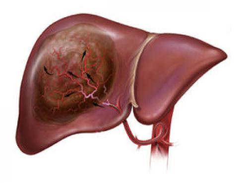 Хром от сладкого. Популярные препараты 09 Хром от сладкого. Популярные препараты 09