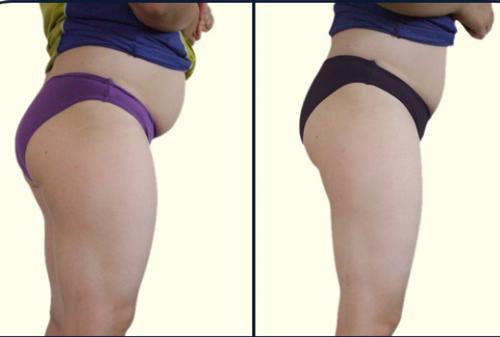 Выход из голодания 30 дней. Каких результатов можно добиться при 30 дневном голодании